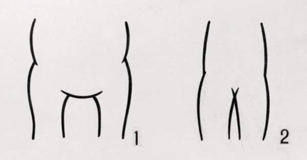 Передняя часть груди:1 — широкая;2 — узкая.