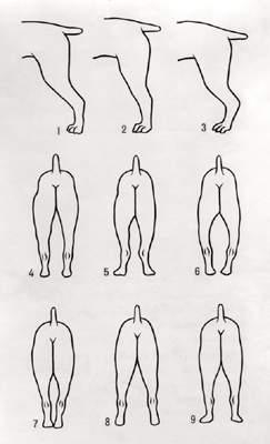 Постав задних конечностей. Сбоку:1 — нормальный;2 — прямой;3 — саблистый. Сзади:4 — нормальный;5 — сближенный в скакательных суставах (коровина);6 — бочкообразный;7 — узкий;8 — широкий;9 — размёт.